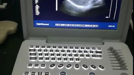 Hospital B/W Digital Portable Ultrasound Scanner for Gyn Gynecologic